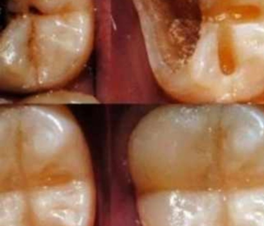 Natural Ways to Maintain Good Dental Health