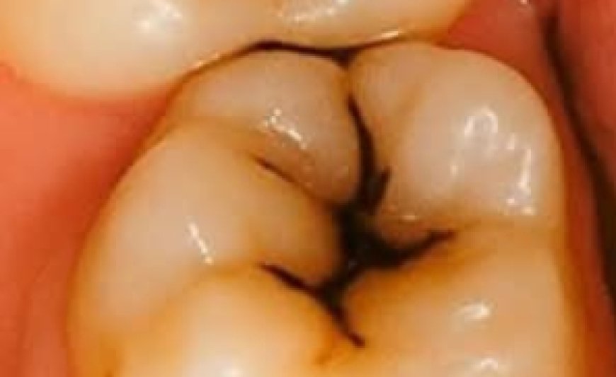 Natural Ways to Protect and Repair Your Teeth