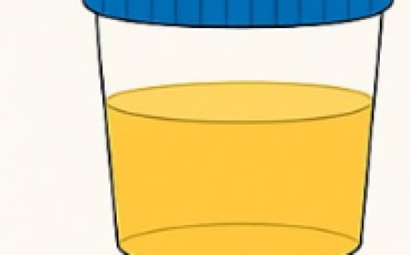 What Your Urine Color May Be Telling You (Gently & Naturally) ????????