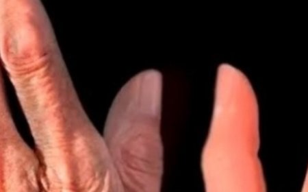 Bay Leaf: A Million Times Stronger Than Botox or Collagen?Smooth Out Wrinkles and Fine Lines Naturally