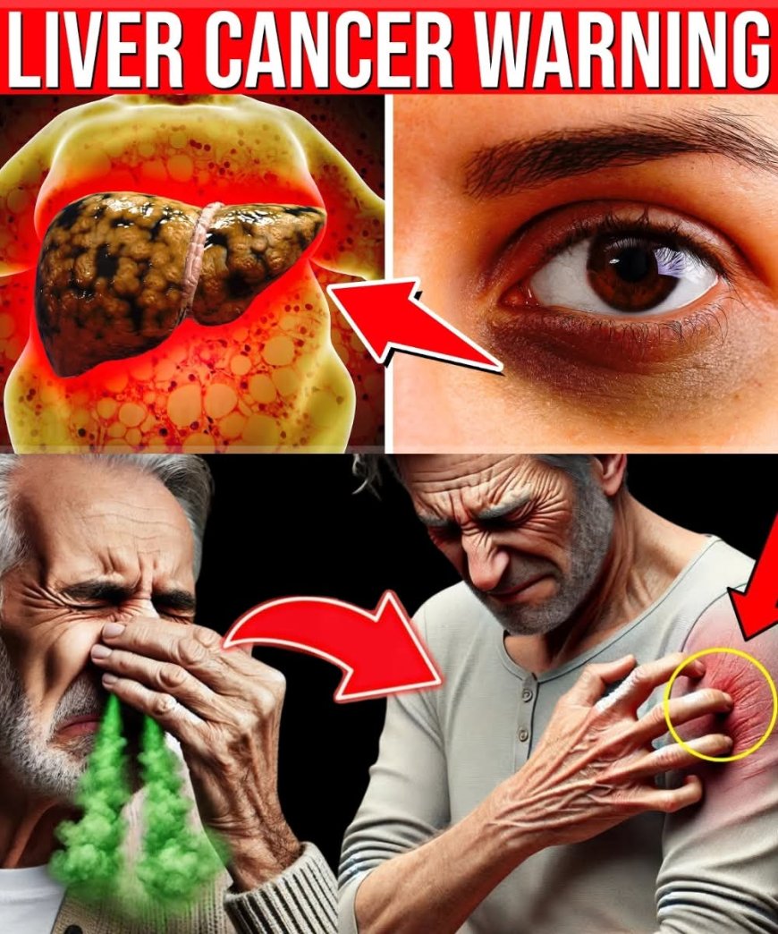 11 Early Liver Cancer Warning Signs You Must Never Ignore! | Healthy Care