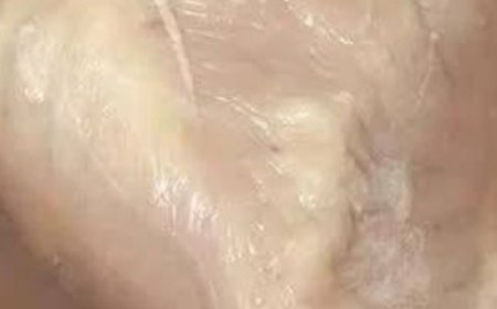 Is it safe to eat that leftover chicken?