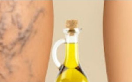 Grandmas Natural Remedy for Varicose Veins Aloe Vera Apple Cider Vinegar and Lemon