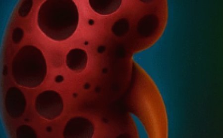 Why Your Kidneys Might Be Asking for Gentle Support