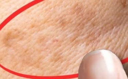 How to Remove Age Spots Naturally with Lemon Juice