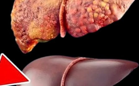 17 Amazing Benefits of Papaya Seeds and How to Use Them as Natural Remedies