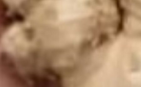 Teeth whitening in 2 minutes