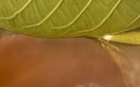 One simple cup of guava leaf tea can help treat liver and kidney diseases.