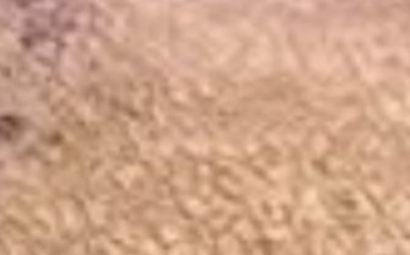 Suffering from Inflamed Kidneys? Cleanse and Purify Them with Just Two