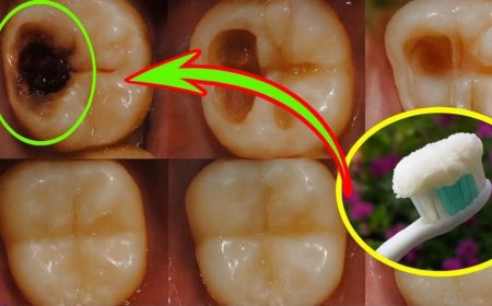 A tiny cavity can spark a wave of dread