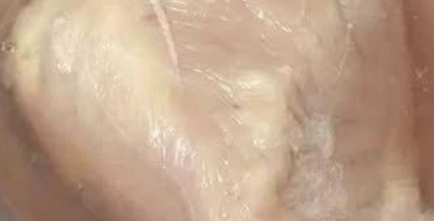 Is it safe to eat that leftover chicken?