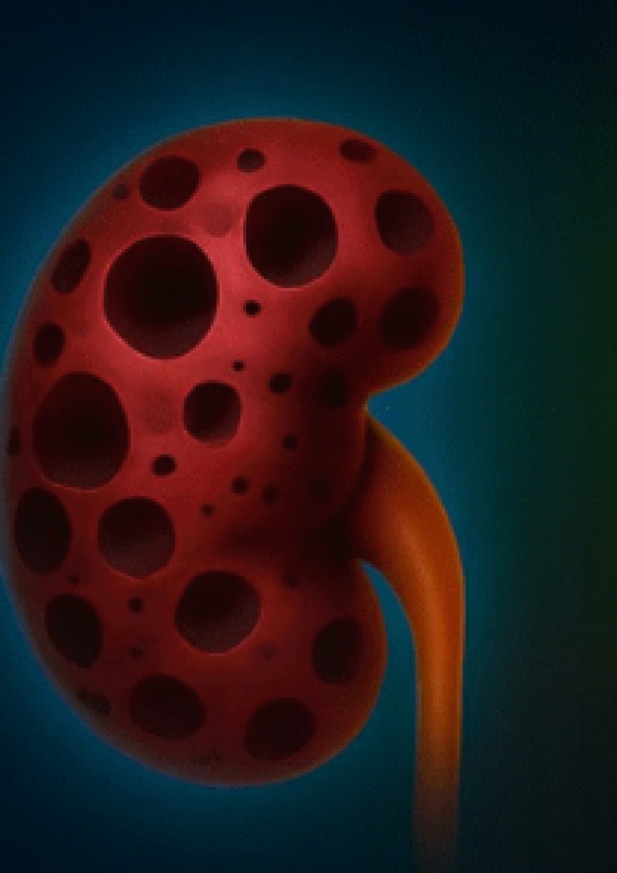 Why Your Kidneys Might Be Asking for Gentle Support