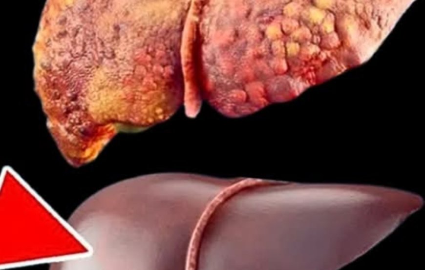 17 Amazing Benefits of Papaya Seeds and How to Use Them as Natural Remedies