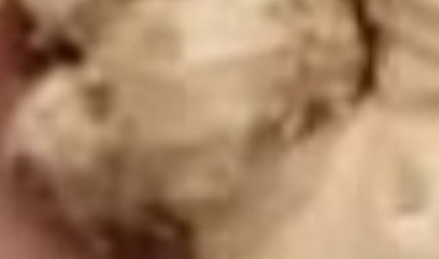 Teeth whitening in 2 minutes